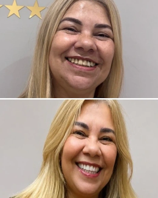 Foto de Paciente