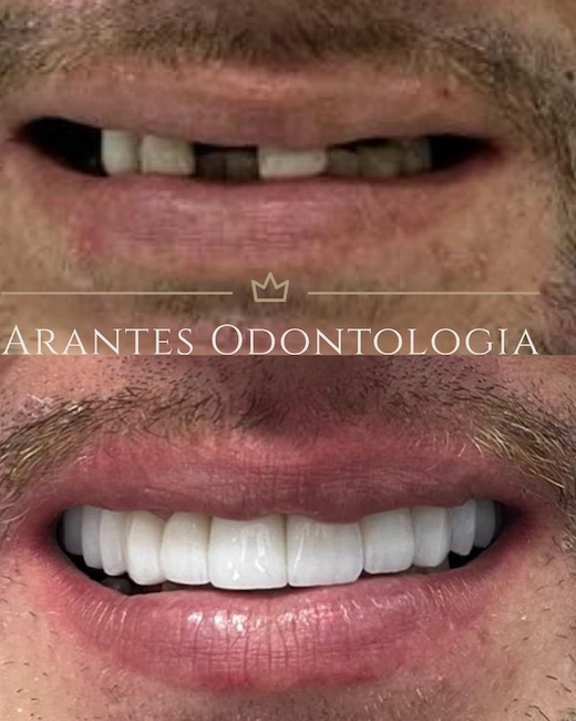 Foto de Paciente