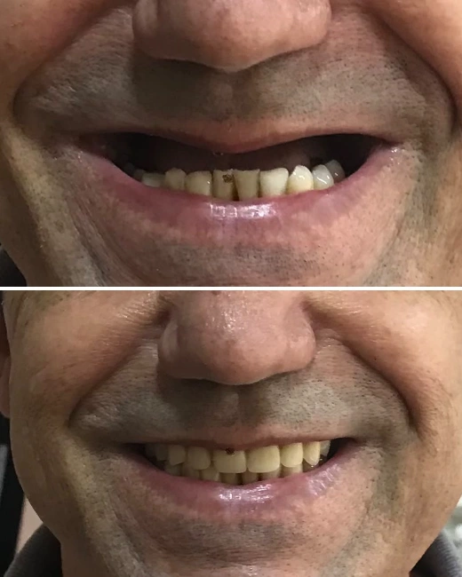 Foto de Paciente