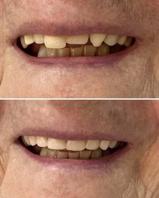 Foto de Paciente