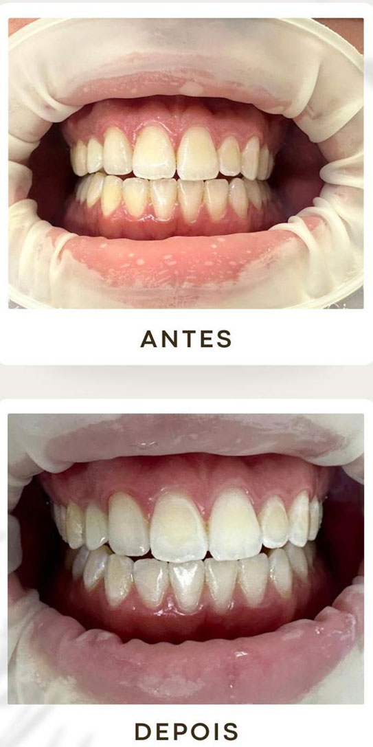 Foto de Paciente