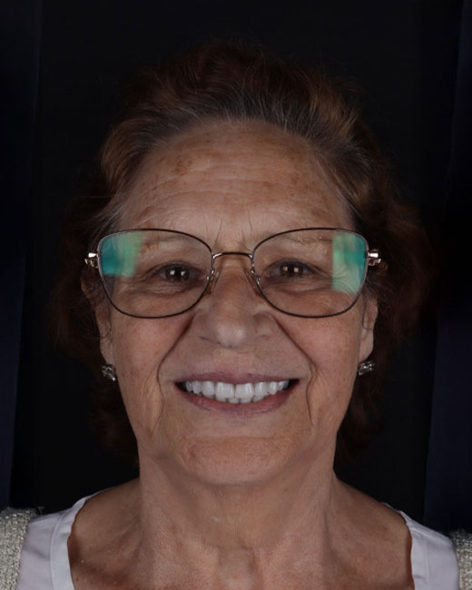 Foto de Paciente