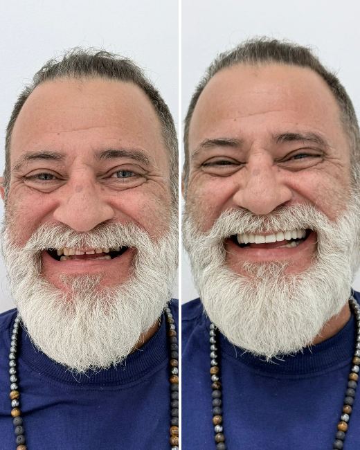 Foto de Paciente