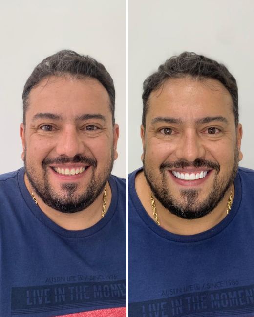 Foto de Paciente