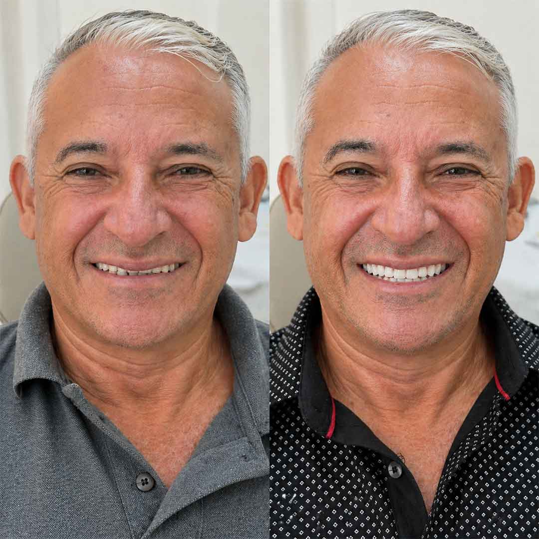 Foto de Paciente