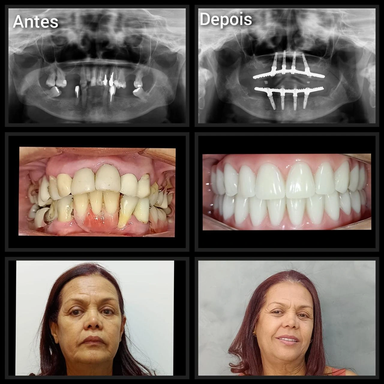 Foto de Paciente