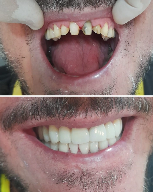 Foto de Paciente