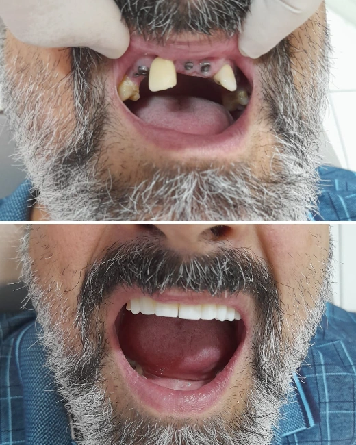 Foto de Paciente